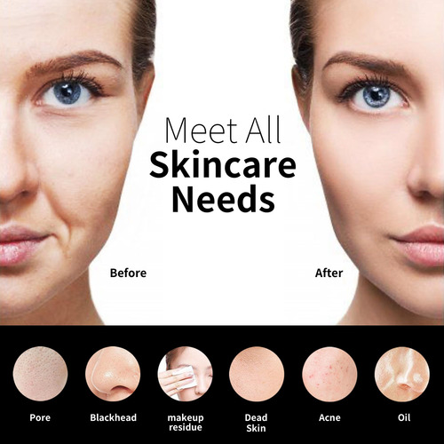 Limpiador Facial De Silicona Recargable Y Resistente Al Agua