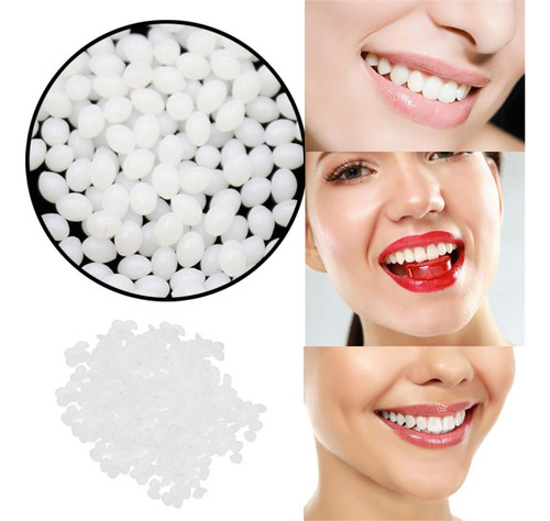 Kit Temporário De Reparo De Adesivo Para Próteses Dentárias