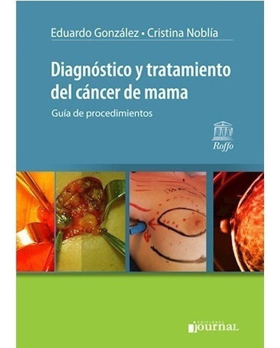Diagnostico Y Tratamiento Del Cancer De Mama
