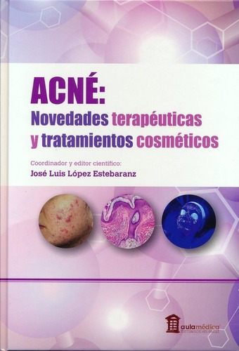 López Acné. Novedades Terapéuticas Y Tratamientos Cosméticos