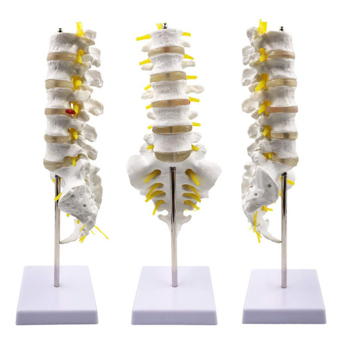 Modelo De Columna Vertebral Humana - Juego De Vértebras Lumb