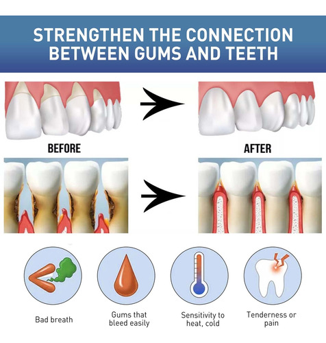 Um Gel De Creme Dental Melhora A Saúde Bucal E Reduz O Sensi