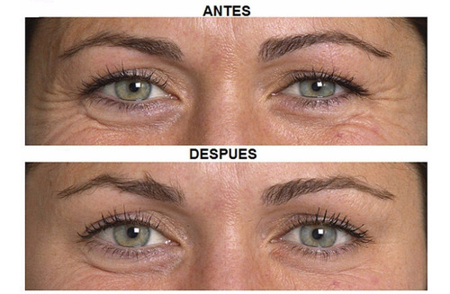 Idraet Rich Plasma Contorno De Ojos Arrugas Bolsas Y Ojeras
