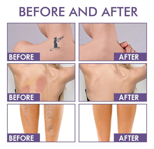 Nuevo Body Coverage Perfector, Maquiagem Para Capa De Tatuag
