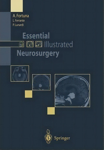 Essential Illustrated Neurosurgery, De A. Fortuna. Editorial Springer Verlag, Tapa Blanda En Inglés