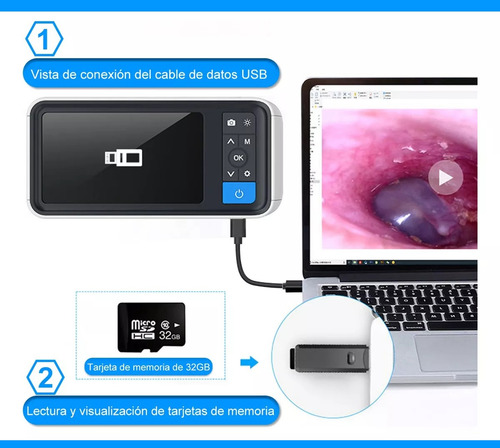Otoscopio Digital 600w Píxel 3.9mm Hd Oído Alcance Endoscopi