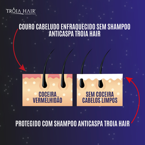 Kit 2 X1 Shampoo Troia Anticaspa Limpeza Diária 2 Em 1 300ml