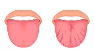 Limpia Lengua Profesional Higiene Bucal Oral Elimina Sarro