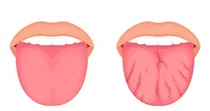 Comprar Limpia Lengua Profesional Higiene Bucal Oral Elimina Sarro 