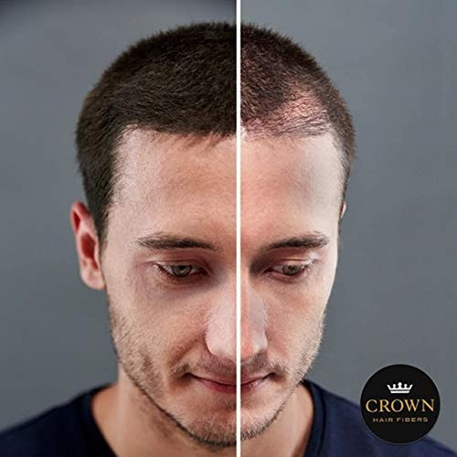 Crown Hair Fibers - Las Mejores Fibras Para El Cabello Con Q