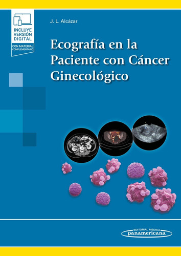 Alcázar Ecografía En La Paciente Con Cáncer Ginecológico