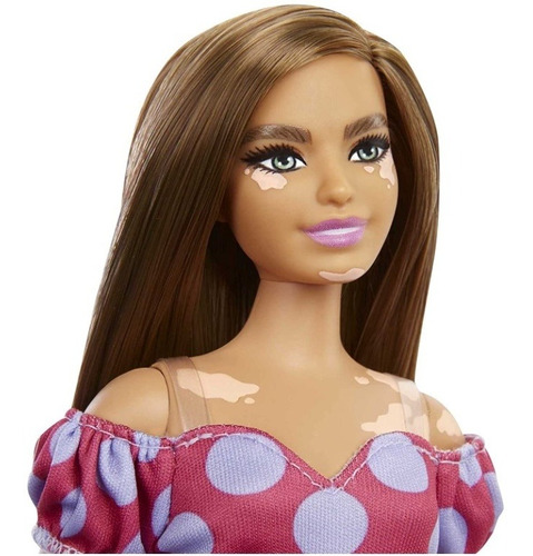 Imagem 2 de 6 de Boneca Barbie Fashionistas 171 Vitiligo Curvy - 2022 Ms