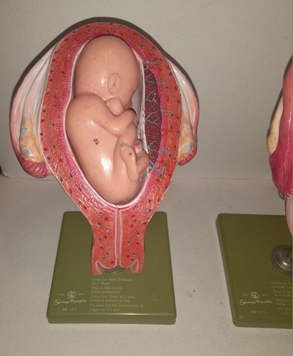 Utero Con Feto Gestacion Modelo De Anatomia Somso Alemania (Usado)