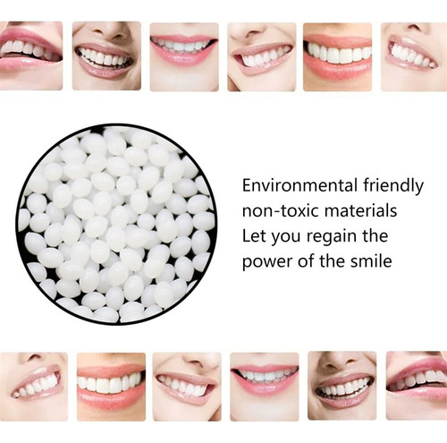 Kit De Reparo De Adesivo Para Dentaduras Com Cola Temporária