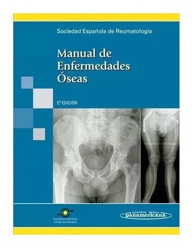 Manual De Enfermedades Óseas Ser, De Ser. Editorial Médica Panamericana En Español