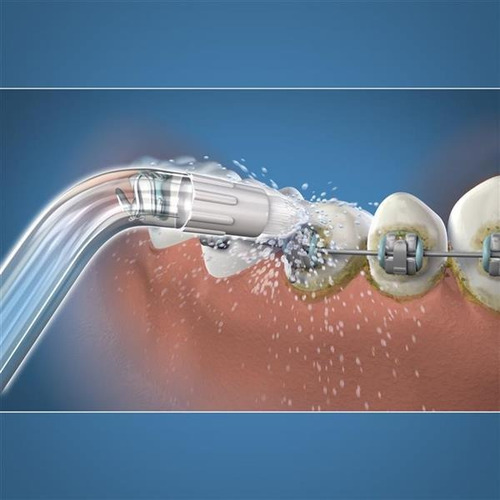 Punta Waterpik Original Ortodoncia Respuesto Picos