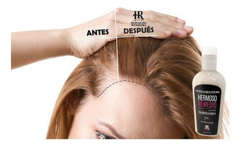 Imagen 3 de 7 de Shampoo Crecimiento Anti Caída Reparador Frizz Mujer 7 En 1