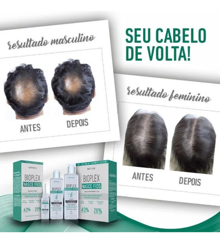 Softhair Kit Nasce Fios Sham. E Tônico Crescimento Antiqueda