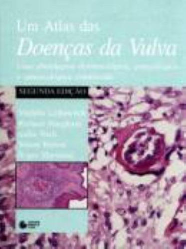 Atlas de Doenças da Vulva: Uma Abordagem Dermatológica, Ginecológica E Venereológica Combinada, de Leibowitch, Michèle. Editora Manole LTDA, capa mole em português, 1998