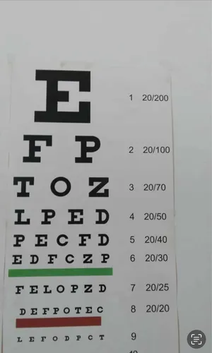 Optotipos Oftalmologicos