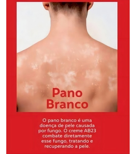Pomada Micosan Pano Branco Para Micoses Em Geral 50g
