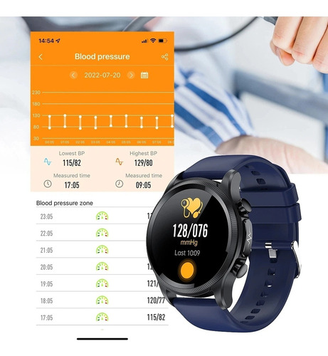 Reloj Inteligente E400 Para Monitorización De Ecg+ppg De Oxí