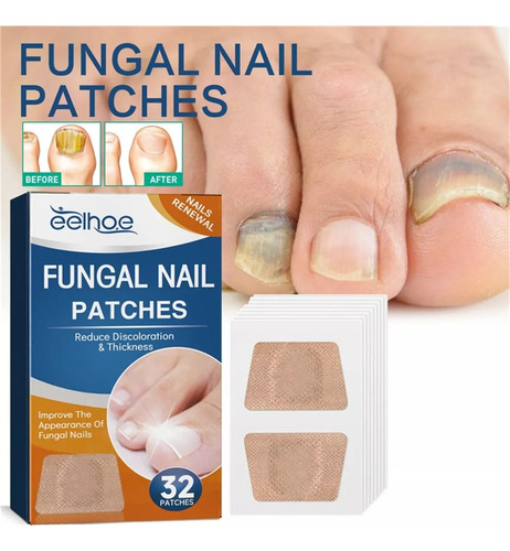Parches De Reparación De Uñas F Nail Patches 1box
