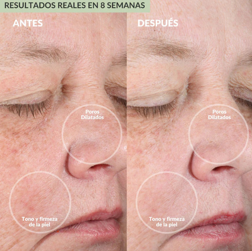 Pmd Clean Cepillo Limpiador Facial Eléctrico Reafirmante Color Berry