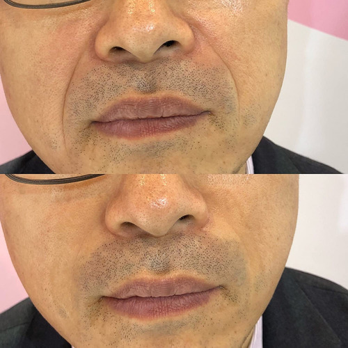 Vitayes Instant Ageback, Ageless Facelift Cream For Instant