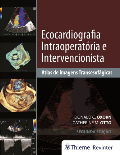 Ecocardiografia Intraoperatória e Intervencionista: Atlas de Imagens Tansesofágicas, de Oxorn, Donald C.. Editora Thieme Revinter Publicações Ltda, capa dura em português, 2018