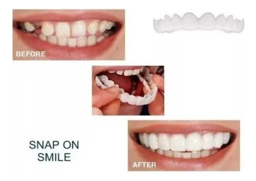 Tampa De Dente Falso Superior Encaixe No Sorriso Perfeito Em