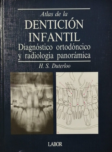 Atlas De La Denticion Infantil: Diagnostico Y Radiologia