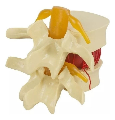 Anatomía Disco Lumbar Columna Vertebral Modelo Enseñando2024
