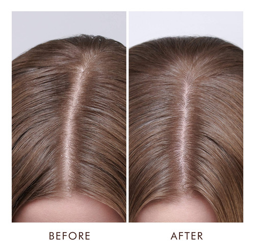 Tratamiento Para Cuero Cabelludo Seco Moroccanoil 45ml