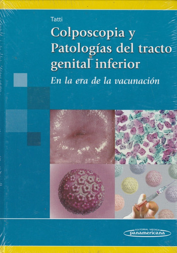 Libro Colposcopia Del Tracto Genital Inferior Tatti Nuevo