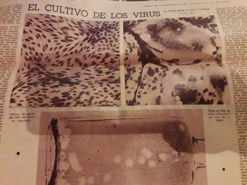 Diario La Prensa Cultivó Virus Museo Romántico Madrid 1968