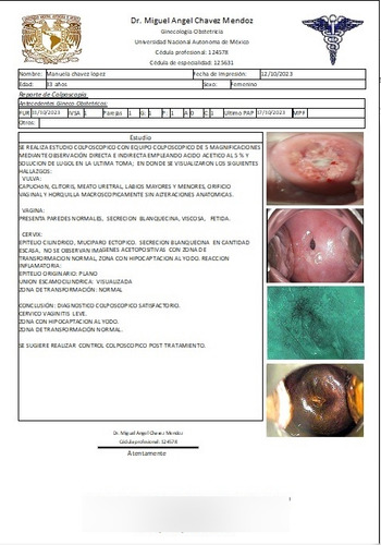 Reporte De Colposcopia + Usg + Pedal Insimed View
