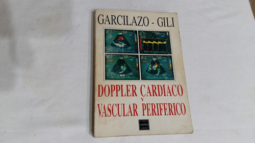 Dopler  Cardiaco Y Vascular Periferico Garcilazo / Gili