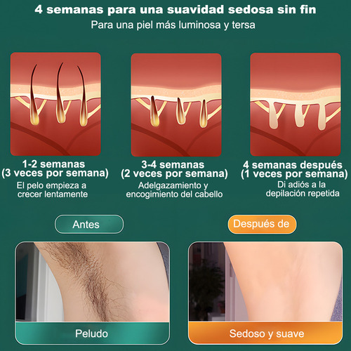. Ipl Depiladora Láser Permanente Flashes For Cuerpo Y Cara