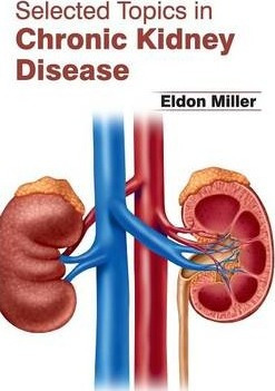 Libro Selected Topics In Chronic Kidney Disease - Eldon M...