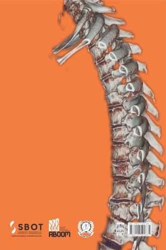 Tratado De Doenças Osteometabólicas