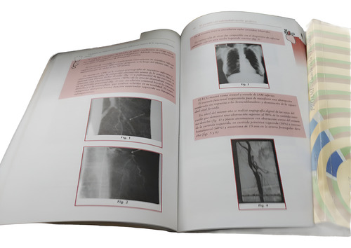 Proami - Medicina Interna Fernando Lasala Ed . Panamericana (Usado)
