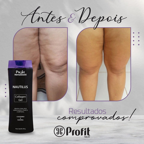 Gel Colageno E Elastina , Nautilus Profit Nemawashi