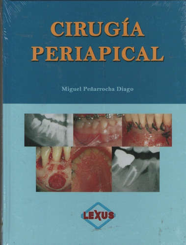 Cirugia Periapical Miguel Penarrocha Diago 