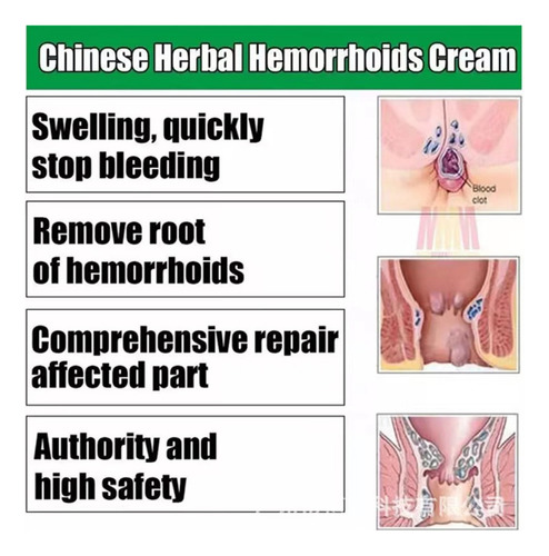 - Crema Para Hemorroides A Base De Hierbas Chinas Gh8g