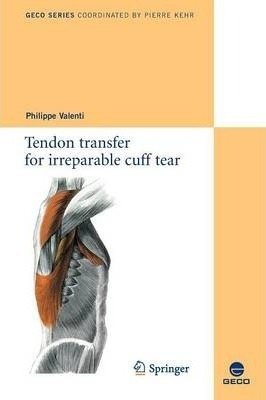 Tendon Transfer For Irreparable Cuff Tear - Philippe Vale...