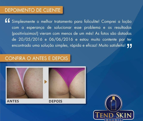 Tend Skin 118ml Loção P/foliculite Pelos Encravados Original