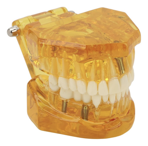 Tipodonto Didactico Dental Anatomía Restauración Implante