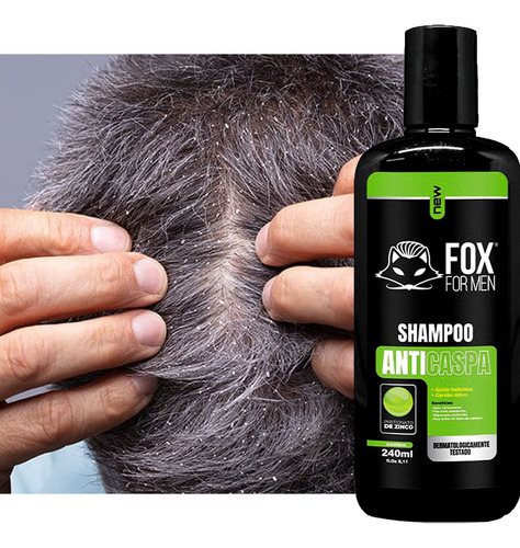 Shampoo Anticaspa Refrescante Limpeza Profunda Xampu Shampu