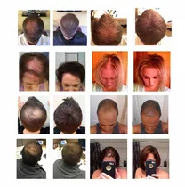 Comprar Cabello Instantaneo Anti Calvicie Hombre Mujer Salud Belleza